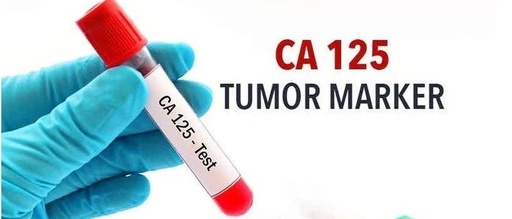 ca125是什么，ca125是什么检查项目是抽血查吗