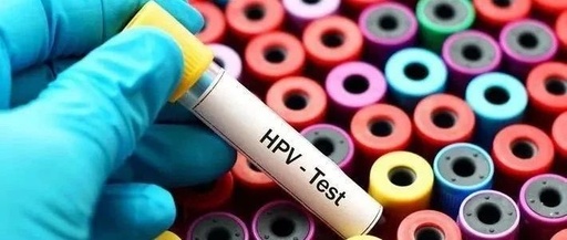 那做HPV病毒检测要多少钱呢？