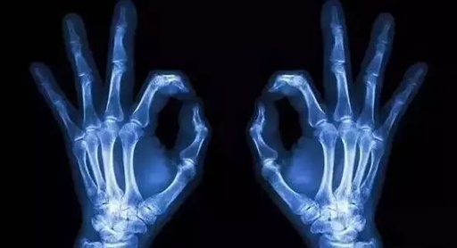 CT和X光有什么不同？